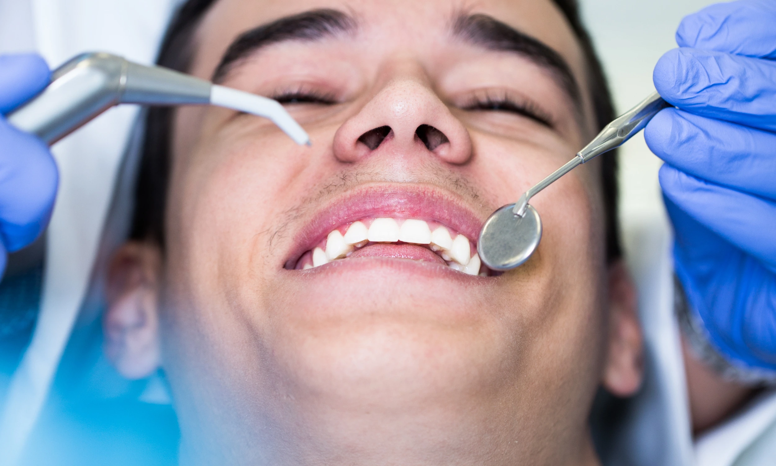 Composite Bonding Cheshire: What to Expect